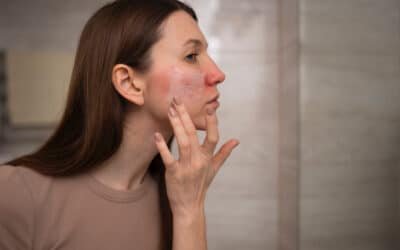 Pelle sensibile e barriera cutanea: come rinforzarla con i cosmetici giusti