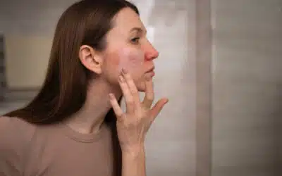 Pelle sensibile e barriera cutanea: come rinforzarla con i cosmetici giusti