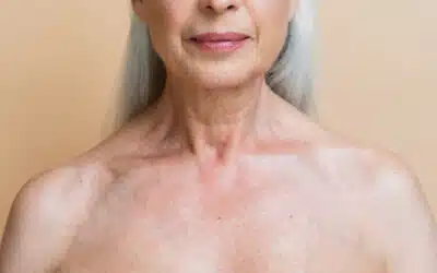 Barriera cutanea danneggiata: sintomi, cause e come ripararla