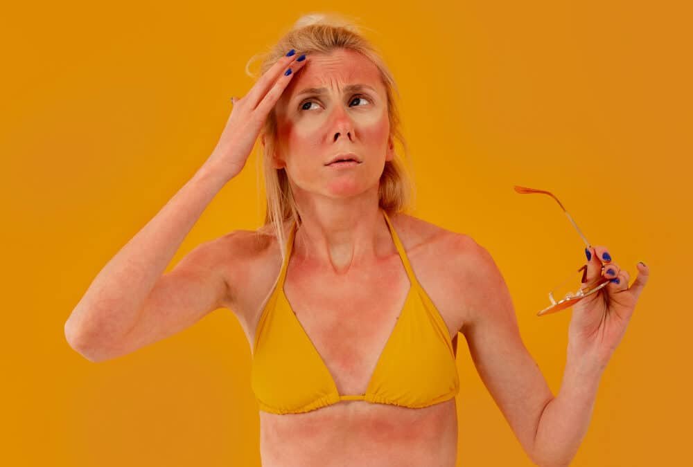 Macchie solari post-estate vs melasma: come riconoscerle e cosa fare (solo cosmetico)