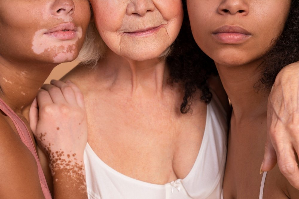 Microbioma cutaneo e bellezza della pelle