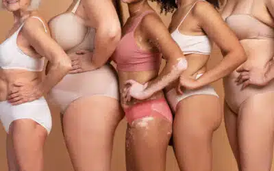 Liposomi nella cura della cellulite: cosa dice la scienza