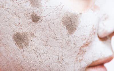 Barriera cutanea danneggiata: segnali e come ripararla