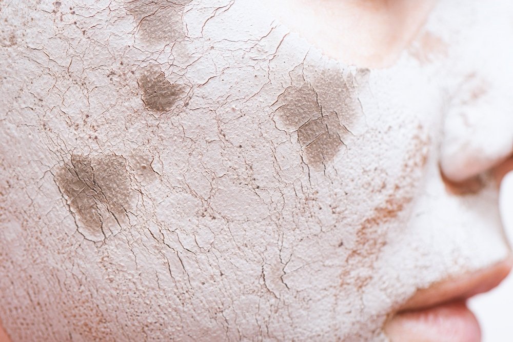 Barriera cutanea danneggiata