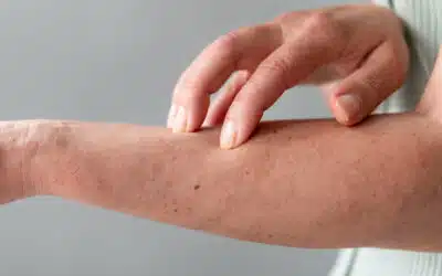 Esposoma cutaneo: come ambiente e stile di vita influenzano la salute della pelle