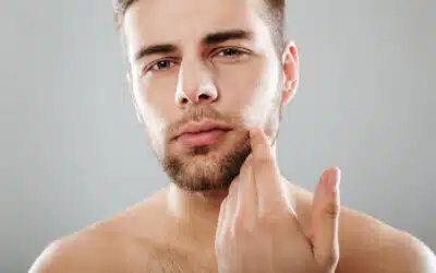 Pseudofollicolite della barba: perché si formano i peli incarniti dopo la rasatura