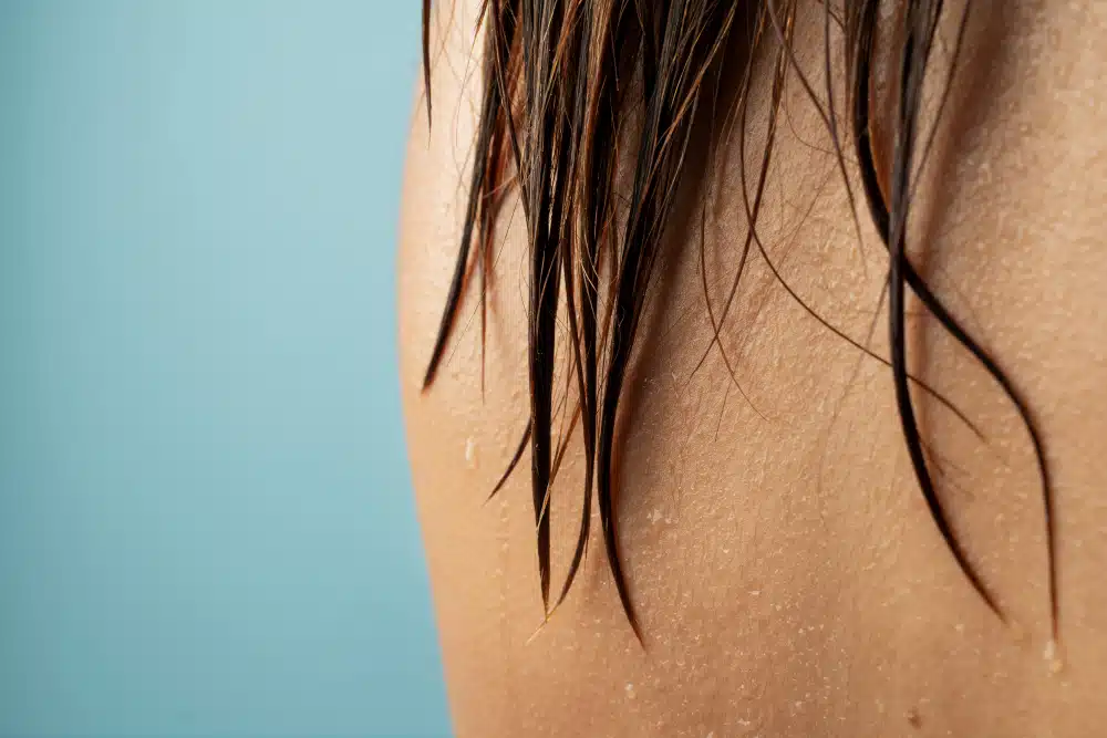 Acqua dura e calcare
